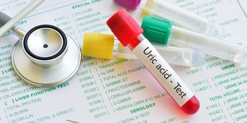 uric acid test