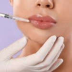 lip fillers IN Dubai