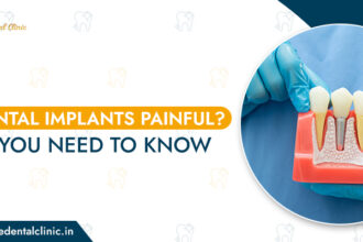 Are-Dental-Implants-Painful-What-You-Need-to-Know