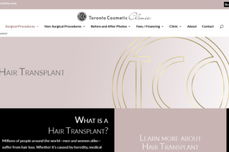 Hair transplant Toronto